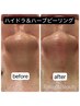 ★新-肌質改善★水光肌！ハイドラ毛穴＆最新ハーブピーリング！通常¥16,250