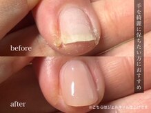 ループ(LooP)の雰囲気(【LooP独自の】自爪を育てる施術)