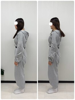 ラフテル鍼灸整骨院/自律神経の乱れを整体でスッキリ