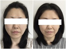 ウェリナ平和堂長久手院/小顔矯正/骨盤矯正/美脚サロン