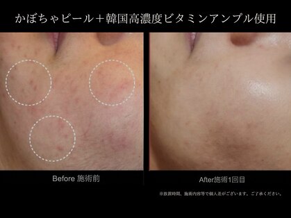 スア(SUA)の写真