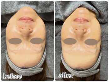 ニュイ(nuit)/プラピール3回目