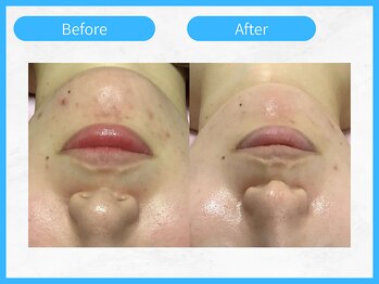 トウメイコガオ 横浜店/