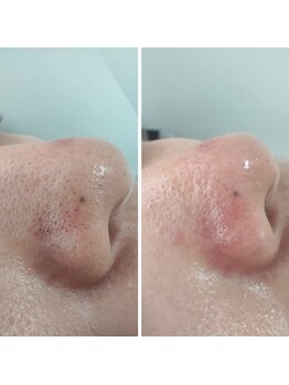 エムスリー(m3)/