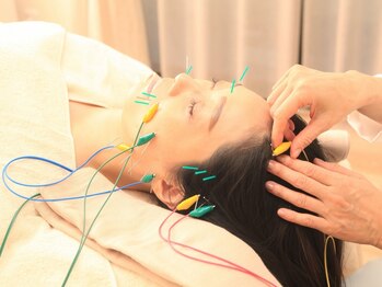 ノアの写真/【完全個室／女性鍼灸師】美容×鍼灸◎優しく気持ち良い鍼灸×美容鍼で身体もお顔も悩みを根本改善！
