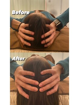 チル 渋谷店(CHILL)/ヘッドスパ後の変化
