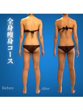 リアン(Lian)/【肩甲骨鎖骨を綺麗にしたい！】