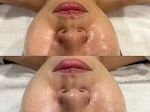 トトノエ(TOTONOE)/クリスティーナ-ビオフィート-