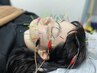 【結果重視◎】シワ・たるみ・ニキビにお悩みの方に！美容鍼60分　7200円