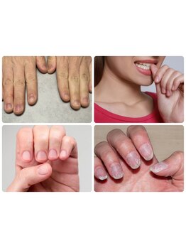 爪の悩みを解消できる（ケア含む）
