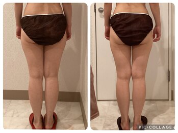 ボーテ(beaute)/【ビフォーアフター】