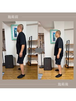 バレルメディカル研究所 恵比寿/夏は急な腰痛が増える