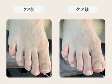 ルポ 伊勢/爪ケア