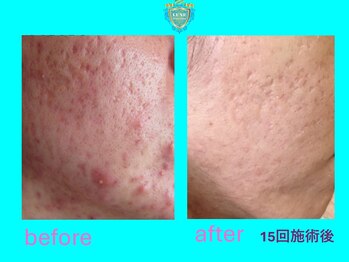 リュクス(LUXE)/ビフォーアフター