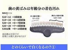 ホワイトニングショップ 多摩店/【どのくらいで白くなるの？】