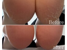 カシェット 広島店(Cachette)/30代女性☆足裏角質ケア60分