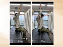 エモア メディカル整体院 恵比寿院(Emoa)/【20代男性】肩・胸椎への施術