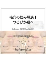 サロン ド ブラン アオヤマ(Salon de BLANC AOYAMA)/毛穴悩みの解消！つるぴか肌へ