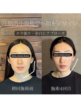 コア 心斎橋 堀江店(koa)/お客様ビフォーアフター!!