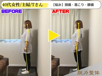 幸せのもり整体院/40代女性/主婦/Tさん