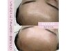 【２回目以降のご予約】人気No.１！一度するとやみつきに艶肌Wax
