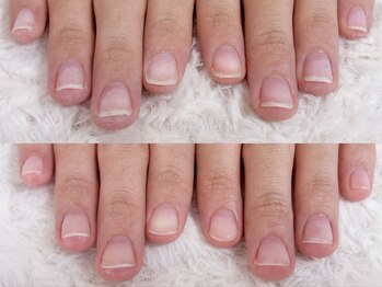 グレースレディ 大阪店/(深爪/長さだし/フィルイン)