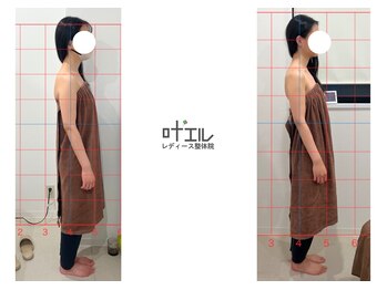 叶'エル 本町 心斎橋院/ブライダル整体姿勢美人