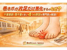 巻き爪じゅん 千葉駅前店/巻き爪片足だけ悪化するのなぜ？