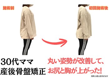 ニノ治療院(Nino治療院)/産後骨盤矯正を受けた変化