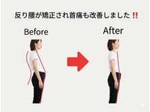 のなか整体院/整体 Before→After
