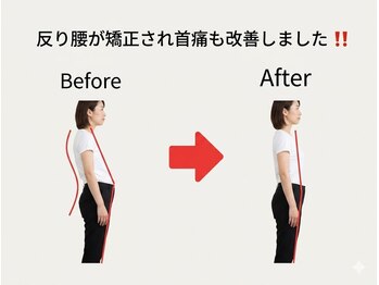 のなか整体院/整体 Before→After