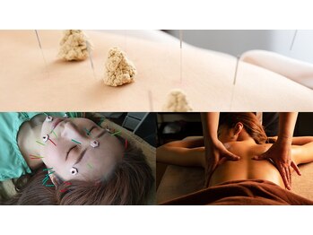 PUNAYU【鍼灸 | アーユルヴェーダ】/スリランカでの経験から