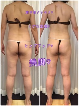 ボディエステティック アクアオーラ 富山店/美ボディ♪