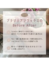 エンジェルワックス 蒲田店(Angel Wax)/【ブラジリアンワックス？？】