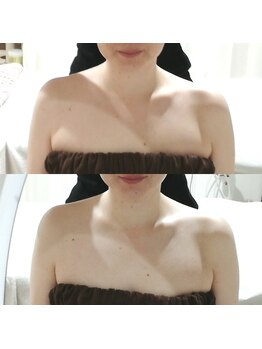 RiとBiのたまご/(ブライダル)引き締め