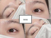 ノア(noa)