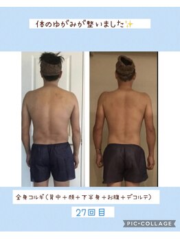 小顔コルギ専門店 フェルーシュ 成田駅前店(Feruche)/男性にも人気な背中コルギ!