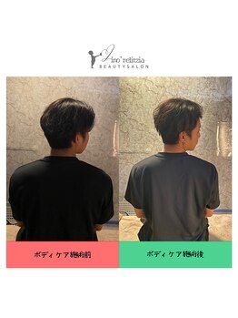 リノレリチア 心斎橋 新町店/