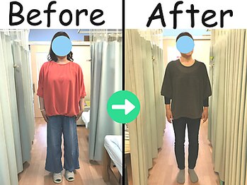 杉本接骨鍼灸院/【痩身】ビフォーアフター