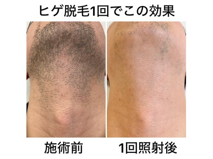 リベール(Le:Belle)の写真