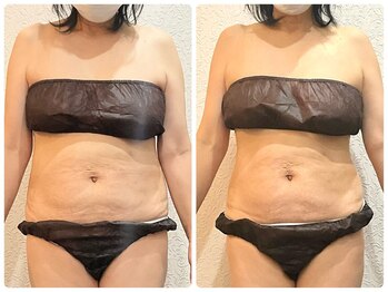 美容整体 ウェリナ 蟹江院/小顔矯正/骨盤矯正/美脚サロン