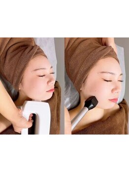 小顔になりたい