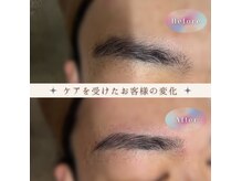 ノンプレックス(NON PLEX)の雰囲気(なりたい理想を確認しお顏のバランスを考慮した上で施術します◎)