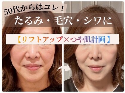 スイッチ(Switch)の写真