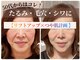 スイッチ(Switch)の写真