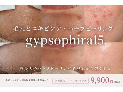 ジプソフィラフィフティドット(gypsophira15.)の写真
