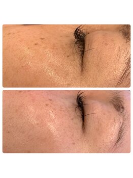 アイラッシュ ミル 御領店(eye lash Miru)/トーンアップ