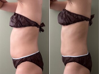 ココア(CoCoa)/トレーニング×最新マシン