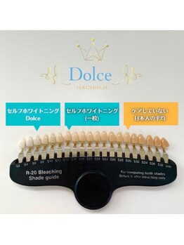 ドルチェ 水戸店(Dolce)/皆さんの歯のお色はどこですか？
