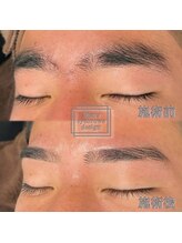 アイブロウマン(i Browman)/アイブロウWAX　施術例